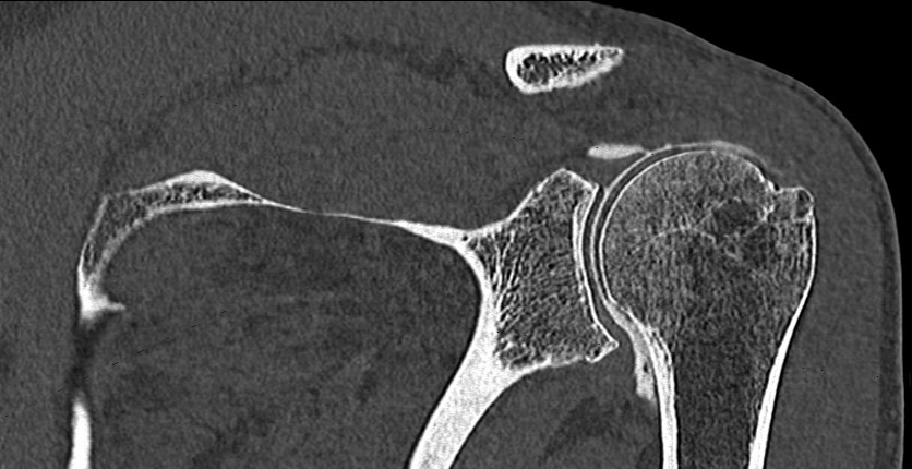 Arthroscanner – IMCSM