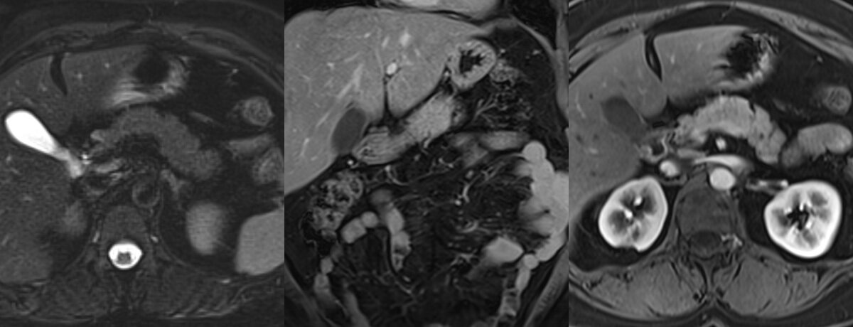 IRM abdominale – IMCSM
