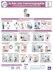 Aperçu fiche mammographie