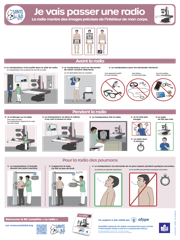 Fiche pratique – Radiographie IMCSM